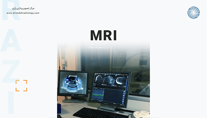 MRI چیست؟