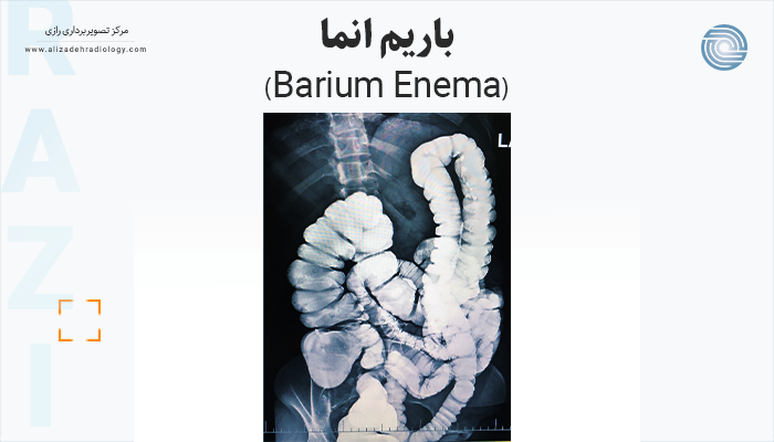 رادیولوژی باریم انما (Barium Enema) برای بررسی روده بزرگ